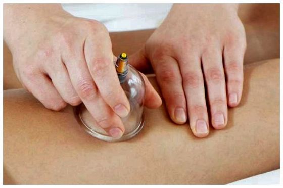 Антицелюлітний масаж банками