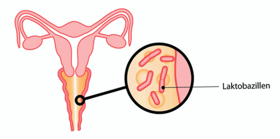 Бактеріальний вагіноз: симптоми, діагностика, методи лікування