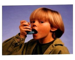Бронхіальна астма у дітей, симптоми