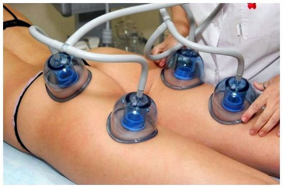 Чим корисний апаратний вакуумний масаж
