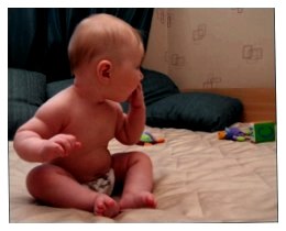 Дитячий нежить: як його лікувати