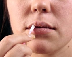 Як позбутися від застуди на губах - прості і дієві рецепти