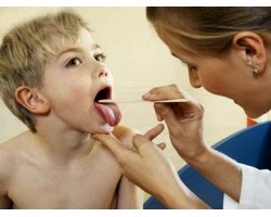 Як лікувати хронічний тонзиліт у дитини