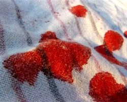 Як відіпрати кров з одягу