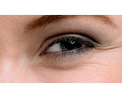 Як запобігти появі зморшок навколо очей