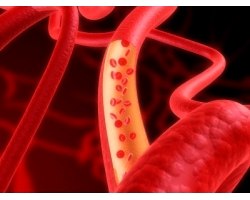Як зміцнити кровоносні судини в організмі людини?