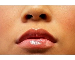 Як вилікувати потріскані губи