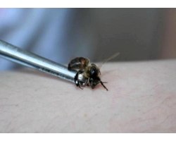 Лікування бджолиною отрутою