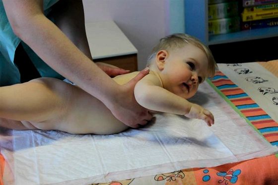 Масаж при дисплазії тазостегнових суглобів у дитини: відео, техніка, поради