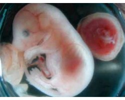 Плацента - особливий орган при вагітності