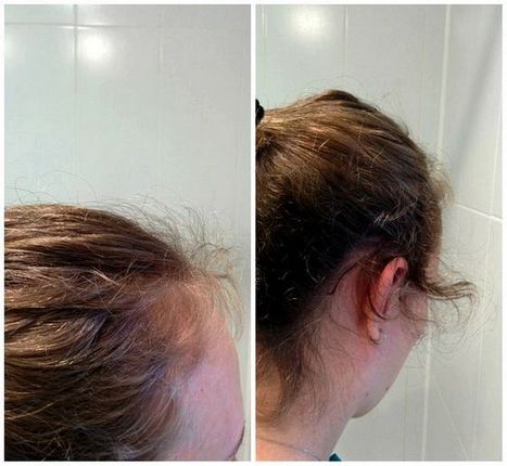Ріп`яна маска: порятунок для сухих і ламких волосся в домашніх умовах