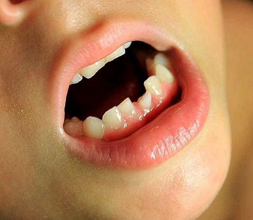 Хитається зуб: як пояснять це сонники?