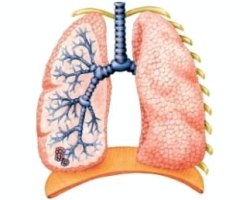 Внутрішні хвороби, захворювання органів дихання