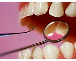 Здорові зуби і правильний догляд